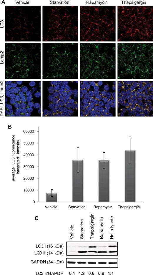Figure 1. Autophagy in CLL cells. (A) Confocal fluorescence microscopy for CLL cells untreated or after 4-hour starvation in HBSS or 4-hour treatment with rapamycin (5μM) or thapsigargin (1μM). LC3 (red) shows autophagosomes. Lamp2 (green) shows lysosomes. 4,6-diamidino-2-phenylindole (blue) shows nuclei. Images were collected with 60× objective and 4× optical zoom. (B) Quantification of LC3 immunofluorescence intensity. Integrated intensity was averaged in 5 microscopic fields relative to number of cells per field and then averaged in 6 CLL patients' cells. Differences from vehicle-treated were significant (P < .0001). (C) Immunoblot for LC3B I and II in CLL cells (representative of 4 experiments). GAPDH was used as loading control.