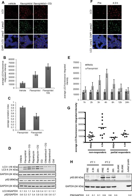 Figure 3. Autophagy in CLL cells treated with the CDK inhibitor flavopiridol. (A) Confocal fluorescence microscopy for CLL cells untreated or treated 4 hours with flavopiridol (2μM) or flavopiridol + CQ (0.5μM). Samples were visualized as in Figures 1 and 2. (B) Quantification of LC3 immunofluorescence in CLL cells from panel A. LC3 fluorescence was increased by flavopiridol and further by the addition of CQ (P < .0001 for the increase with flavopiridol vs vehicle, the increase with flavopiridol + CQ vs vehicle, and the increase of flavopiridol + CQ vs flavopiridol). (C) Quantification of LC3-Lamp2 colocalization by average correlation index in 6 CLL samples treated with flavopiridol or flavopiridol + CQ as in panel A. The decreased colocalization with CQ was significant (P < .0001). (D) Immunoblot for LC3B I and II and p62, representative of 3 experiments. (E) Quantification of LC3 immunofluorescence in a time course with flavopiridol. After incubations, CLL cells (n = 3) were collected by cytospin at the specified time points. Samples collected after the 4-hour time point were washed and resuspended in media without flavopiridol for the remainder of the incubation. The increase in LC3 fluorescence flavopiridol compared with vehicle was significant (P = .001) at 3, 4, and 8 hours and decreased to levels comparable with vehicle alone at 12 and 24 hours. (F) Confocal fluorescence microscopy of CLL cells obtained from patients treated with flavopiridol. Samples were collected before treatment and at the end of flavopiridol infusion (4.5 hours) and visualized as in previous figures. (G) Average of LC3 fluorescence in CLL cells (n = 16) collected from patients treated with flavopiridol, showing LC3 intensity before treatment (PRE) and at the end of flavopiridol infusion (4.5 hours). Overall, LC3 intensity was 1.44 times higher in nonresponders compared with responders (95% CI, 1.07-1.95; P = .0183). Although the increase in intensity 4.5 hours versus before treatment was slightly higher for nonresponders compared with responders (fold change of 2.51 vs 1.82), it was not significantly higher (P = .3445). (H) Immunoblot for p62 in samples from CLL patients treated with flavopiridol. Samples were collected before treatment, at the end of flavopiridol infusion (4.5 hours), and at 24 hours from beginning of infusion. Data shown are representative of samples from 8 patients.