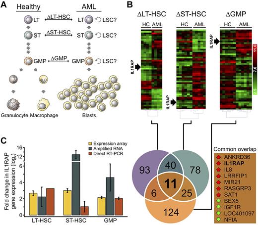 Figure 1. Transcriptional profiling of phenotypic hematopoietic stem and progenitor compartments of AML patients with monosomy 7 identifies overexpression of IL1RAP. (A) Schematic showing the cell types used for pairwise comparison of gene expression. Phenotypically defined hematopoietic stem and progenitor compartments with potential LSC activity were sorted and compared between healthy and AML individuals. The symbol “Δ” refers to the gene expression differences between groups in each phenotypically defined compartment: LT-HSCs, ST-HSCs, and GMPs. (B) Hierarchical clustering of the 50 most significantly dysregulated genes in −7 AML in phenotypically defined LT-HSCs, ST-HSCs, and GMPs of AML patients compared with HC. Heat maps of log2-transformed gene expression levels are shown (top). Position of IL1RAP is indicated. Venn diagram (bottom) shows the number of differentially expressed genes that are shared between, or restricted to, specific compartments between AML samples and HC. The numbers represent the total of up- or down-regulated genes in each pairwise comparison. Genes in the triple intersection (common overlap) are listed. Red and green arrows indicate overexpression and down-regulation in the AML samples, respectively. (C) Validation of IL1RAP mRNA expression in LT-HSCs, ST-HSCs, and GMPs. Yellow bars represent expression levels in the gene expression array (n = 4 for LT-HSCs, n = 5 for ST-HSCs, and n = 6 for GMPs). Blue bars represent mRNA levels determined by quantitative RT-PCR in amplified RNA (n = 2). Red bars represent the mRNA levels measured by quantitative RT-PCR from unamplified cDNA (n = 1 for LT-HSCs and n = 2 for ST-HSCs and GMPs). mRNA levels were normalized to GAPDH. Fold change compared with HC is shown.