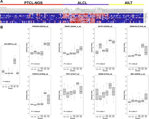 Figure 2. Class-prediction analysis identifies a genomic classifier for ALK− ALCL. (A) Heat map showing the expression of the 6 genes included in the Prediction Analysis of Microarrays classifier, together with ALK, GZMB, and PRF1 in ALCL, PTCL-NOS, and AITL used in the analysis. (B) Box-plot representation of the same genes in the full dataset of 249 samples, including normal donors and adult T-cell leukemia/lymphoma tumors. The Kruskal-Wallis P value is indicated for each transcript.
