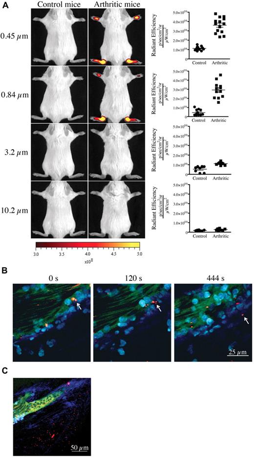 Figure 2. Presence of vasculature permeability during autoimmune arthritis in vivo. (A) Nonarthritic control (left) and arthritic (right) mice (day 7 after K/BxN serum injection) were injected intravenously with 0.45-, 0.84-, 3.2-, or 10.2-μm-diameter microspheres and visualized 5 minutes later using a Xenogen IVIS in vivo imaging system. Control and arthritic mice received the same concentration of fluorescent microspheres. Radiant efficiency quantifications in the ankle joints for control and arthritic mice for all microsphere sizes are presented at right. (B-C) In vivo 2-photon imaging of the vasculature permeability in the arthritic ankle joint. LysM-eGFP arthritic mice injected intravenously with dextran-fluorescein and 0.45 μm Nile-Red-conjugated microspheres, and ankle joints were imaged to visualize the microsphere egress from the blood circulation and accumulation in the subendothelial collagen-rich matrix. (B) Two-photon images from time-lapse recordings taken at 0, 120, and 444 seconds demonstrating a microsphere leaving the blood circulation independently of transportation by a neutrophil or a monocyte. (C) Representative image evidencing the accumulation of microspheres outside the vasculature in an arthritic joint. Red represents microspheres; green, blood vessels; cyan blue, leukocytes; and Indigo blue, collagen (second-harmonic generation). Scale bar represents 25 μm (panel B), and 50 μm (panel C).