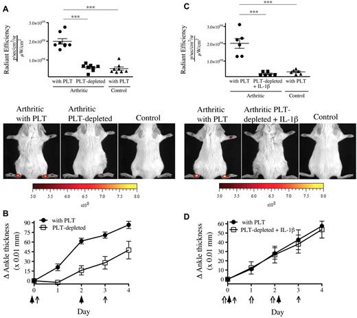 Figure 3. The presence of gaps in the inflamed arthritic joint vasculature depends on platelets. (A) The platelet-depleting antibody or the isotype control antibody was injected to mice on day 0 and day 3. Arthritis was induced by injection of 75 μL of K/BxN serum on day 0 and day 2. On day 4, the 0.45-μm microspheres were intravenously injected in platelet (PLT)–depleted mice and control mice (with PLT), and the fluorescence was measured in ankle joints 5 minutes later. Nonarthritic mice were used as controls. Representative results are presented. ***P < .0001. (B) The signs of arthritis were monitored daily and presented as mean ± SEM. Arrow indicates parenteral administration of platelet-depleting antibody or isotypic control; and arrowheads, K/BxN serum administration. (C) Antibody injection, arthritis induction, microsphere injection, fluorescence measurements, controls, and results presentation were performed as in panel A. Mouse recombinant IL-1β was injected on days 0, 1, and 2 in mice receiving the platelet-depleting antibody. ***P = .0002 (top). ***P = .0001 (bottom). (D) The signs of arthritis were monitored as in panel B. Arrow indicates parenteral administration of platelet-depleting antibody or isotypic control; arrowheads, K/BxN serum administration; and double arrow, IL-1β administration.