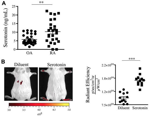 Figure 4. Serotonin is present in the SF of patients with RA and can promote the gap formation in joint vasculature. (A) Serotonin concentrations were measured in SF of RA and OA patients using an ELISA serotonin kit (n = 27). **P = .0012. (B) Serotonin suffices to promote prompt formation of gaps in joints. Diluent (PBS) or serotonin (20 mg/kg) was injected intravenously in mice before administration of 0.45-μm-diameter fluorescent microspheres. The fluorescence was portrayed using an in vivo imaging system 45 minutes after the microsphere injection (left). The radiant efficiency quantifications in the ankle joints for control (diluent) and serotonin injections are presented on the right. ***P < .0001; *P = .024.