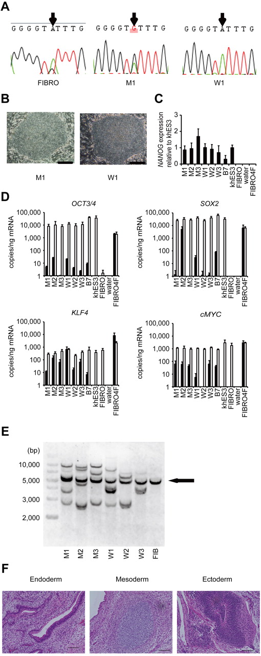 Figure 1. Establishment and characterization of iPSCs. (A) Sequencing of the NLRP3 1709 A > G mutation (Y570C) in fibroblasts (FIBRO), mutant iPSCs (M1), and wild-type iPSCs (W1) in patient 1. (B) The morphology of the mutant and wild-type iPSCs. (C) NANOG expression in CINCA iPSCs, control iPSCs (B7), control ESCs (khES3), fibroblasts (FIBRO), and fibroblasts transduced with 4 factors (FIBRO4F) normalized to GAPDH. n = 3. (D) A quantitative RT-PCR assay for the expression of OCT3/4, SOX2, KLF4, and cMYC in iPSCs. One primer set detects only the transgene (in black), and the other primer set detects both the transgene and endogenous gene (in white). n = 3. (E) Retroviral transgene integration analyses. Southern blot analyses were performed with DIG-labeled DNA probes against c-MYC. The parental fibroblasts carried a band in common with all of the iPSC lines (arrow). (F) A teratoma derived from a mutant iPSC clone, M1. Scale bars represent 100 μm. Data are mean ± SEM.