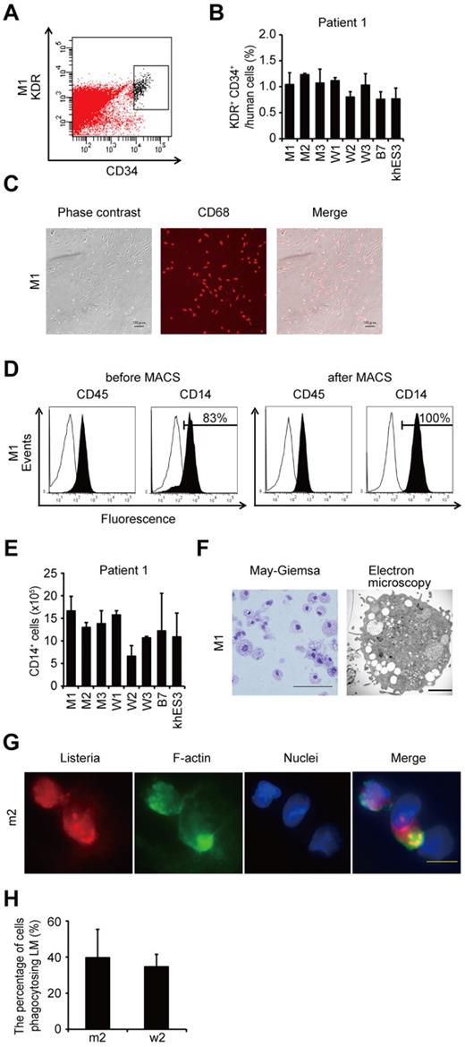 Figure 2. Differentiation and characterization of iPSCs-derived macrophages. (A) KDR+ CD34+ hematopoietic progenitors purified 10 days after differentiation. (B) The percentage of KDR+ CD34+ cells in Tra-1-85+ human cells. n = 3. (C) CD68 immunostaining of macrophages. Scale bars represent 100 μm. (D) The histograms show antibody staining (in black) relative to the isotype-matched controls (in white) for a blood cell marker (CD45), and a macrophage marker (CD14), in cells before (left 2 panels) or after (right 2 panels) magnetic-activated cell sorting purification. (E) CD14+ cell counts obtained from iPSCs plated on an OP9 feeder layer on one 100-mm dish. n = 3. (F) Representative morphology of iPS-MPs evaluated by May-Giemsa staining or transmission electron microscopy. Scale bars represent 100 μm and 2 μm, respectively. (G) The phagocytosis by iPS-MPs after LM infection. The cells were treated with anti-LM antibody, phalloidin, and 4′,6-diamidino-2-phenylindole. Scale bar represents 20 μm. (H) The percentage of iPS-MPs phagocytosing LM was calculated as the average of 9 fields of vision. Data are mean ± SEM.