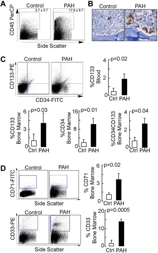 Figure 1. NOD-SCID engraftment potential of CD133+ cells. Purified human BM CD133+ cells were engrafted into NOD-SCID mice by IV injection. After 6 weeks or when animals showed signs of adverse events, BM cells were isolated from NOD-SCID mice and analyzed for the presence of human cells. (A) Flow cytometric analysis for human CD45 expression. (B) Immunohistochemical staining of NOD-SCID BM for human-specific MHC-1 Abs. B indicates bone. Scale bar indicates 100 μm. (C-D) Flow cytometric analysis for human progenitor cell subsets (C) and human hematopoietic lineage engraftment (D).