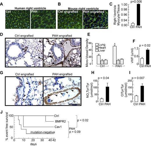 Figure 3. Right heart hypertrophy, angiogenic remodeling, and morbidity induced by CD133+ cells. (A-B) Right ventricular hypertrophy in human PAH and in mice engrafted with human CD133 cells, respectively. Germ agglutinin staining was performed to visualize the myocyte wall. Scale bar indicates 100 μm. (C) Planimetric analysis of myocyte cross-sectional area of right ventricles per total tissue area. Germ agglutinin and lectin stainings were performed to visualize myocyte wall and blood vessels, respectively. (D) Immunohistochemistry of VWF-positive vessels in lungs of mice engrafted with control or PAH CD133+ cells. Scale bar indicates 200 μm. (E) Quantification of microvessel density of lungs, heart, and liver. *P = .001 compared with control. (F) Plasma levels of VWF quantified by ELISA are higher in mice receiving PAH cells. (G) Immunohistochemistry of nitrotyrosine identified increased oxidative stress in the pulmonary vascular wall among PAH recipients. In the control engrafted mice, gray arrows indicate weak positivity in airway epithelial cells, which normally produce nitric oxide and reactive nitrogen species via expression of nitric oxide synthases,50 and black arrowheads indicate negative immunoreactivity of healthy vascular endothelium. In the PAH-engrafted mice, black arrowheads identify nitrotyrosine-positive vascular cells. Scale bar indicates 100 μm. (H-I) Mass spectrometric quantification of nitrotyrosine and chlorotyrosine in the lungs. (J) Morbidity of CD133+-engrafted mice. NOD-SCID mice were engrafted by IV injection with sorted CD133+ cells after total body irradiation. Animals were monitored for 6 weeks. Morbid events in each group are shown.