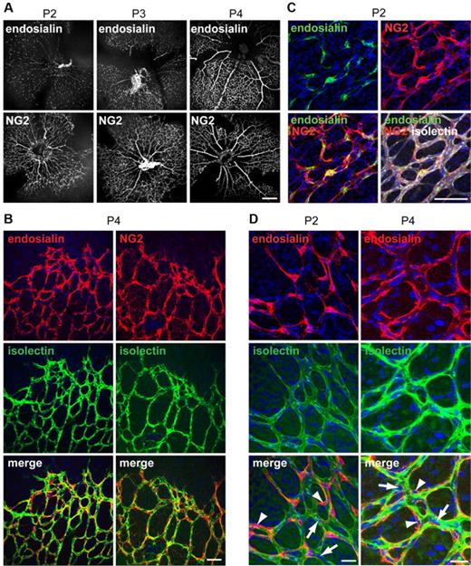Figure 1. Expression of endosialin in the postnatal mouse retina. Whole-mount retinas from P2, P3, and P4 wild-type 129/SvJ mice were stained as follows. (A) Anti-endosialin or anti-NG2 polyclonal Ab followed by Alexa Fluor 555 anti–rabbit Ig. Scale bar indicates 250 μm. (B) Anti-endosialin or anti-NG2 polyclonal Ab and Alexa Fluor 555 anti–rabbit Ig (red), FITC–isolectin B4 (green), and DAPI (blue). Scale bar indicates 50 μm. (C) Anti-endosialin mAb 3K2L (supplemental Figure 2) and anti–rat Ig (green), anti-NG2 and anti–rabbit Ig (red), FITC–isolectin B4 (white), and DAPI (blue). Scale bar 50 μm. (D) Anti-endosialin polyclonal Ab followed by Alexa Fluor 555–anti–rabbit Ig (red), FITC–isolectin B4 (green), and DAPI (blue). Endosialin expression is detected on pericytes (arrowheads) but not endothelial cells (arrows). Scale bar indicates 25 μm.