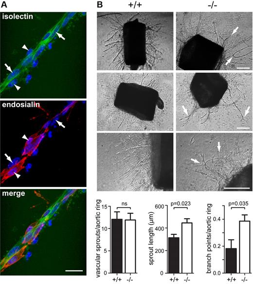 Figure 3. Loss of Endosialin results in aberrant vascular sprouts in the aortic ring outgrowth assay. Thoracic aortae were dissected from Endosialin+/+ or Endosialin−/− 129/SvJ mice, embedded in a collagen I matrix and cultured for 6 days in the presence of VEGF-A. (A) Fixed wild-type aortae stained with FITC–isolectin B4 (green) and anti–mouse Endosialin Ab followed by Alexa Fluor 555–anti–rabbit Ig (red). Nuclei were counterstained with DAPI. Image shows a vascular sprout with expression of Endosialin on pericytes (arrowheads) but not endothelial cells (arrows). Scale bar indicates 25 μm. (B) Phase-contrast images illustrating increased vascular branching in Endosialin−/− outgrowths (arrows). Scale bar indicates 200 μm. Quantification of aortic ring vascular sprout number (n = 12), sprout length (n = 5), and branch point number (n = 5) per aortic ring. Data shown are means ± SEM.
