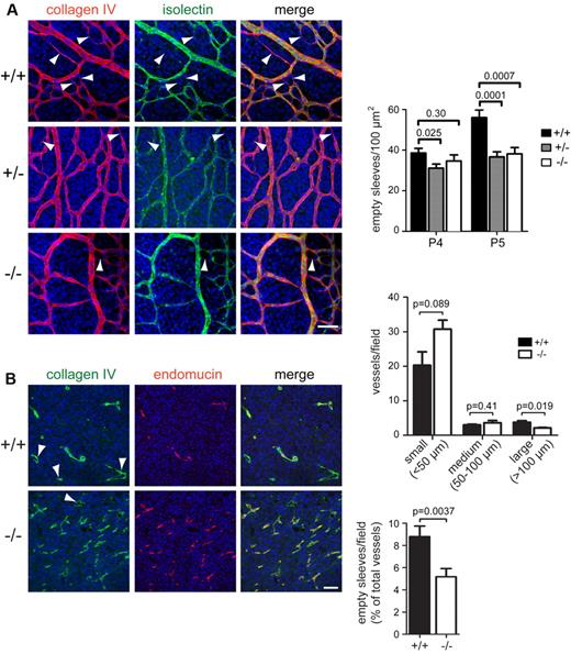 Figure 5. Loss of Endosialin leads to a defect in selective vessel regression. (A) Retinas from littermate Endosialin+/+, Endosialin+/−, and Endosialin−/− C57BL/6 mice were stained with FITC–isolectin B4 (green), the basement membrane marker collagen IV (red), and DAPI (blue). Left panel, representative confocal images from P5 retinas. Arrowheads show collagen IV–positive, isolectin B4–negative empty sleeves indicating vessel regression. Scale bar indicates 25 μm. Right panels, quantification of mean number of empty sleeves ± SEM. Endosialin+/+: P4, n = 4; P5, n = 7. Endosialin+/−: P4, n = 5; P5, n = 5. Endosialin−/−: P4, n = 3; P5, n = 3. (B) B16-F0 melanoma xenografts grown for 14 days in Endosialin+/+ or Endosialin−/− mice (mean tumor diameter, 7.1 mm) were formalin fixed, paraffin embedded, and sections were stained for collagen IV (green) and endomucin (red). Nuclei were counterstained with DAPI (blue). Arrowheads show collagen IV–positive, endomucin-negative empty sleeves. Scale bar indicates 100 μm. Graphs show the distribution of vessel size and the number of empty sleeves as a percentage of total vessels ± SEM. Endosialin+/+: n = 3; Endosialin−/−: n = 3.