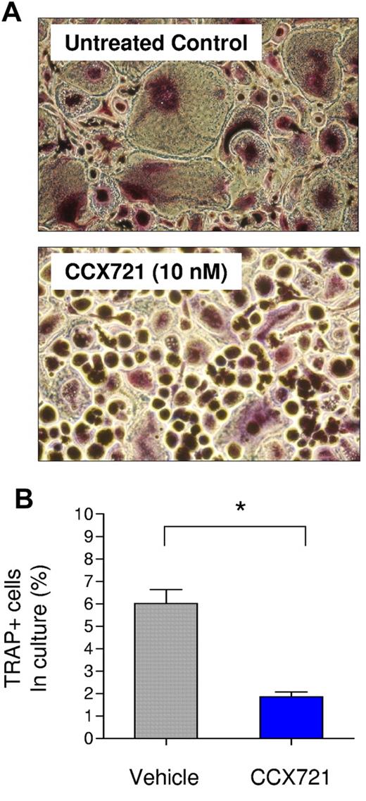 Figure 6. CCR1 blockade inhibits formation of mature OCs. (A) Representative images of monocyte cultures, grown in the presence of added RANKL and M-CSF, forming mature OCs, as shown by TRAP staining (red). Cultures were grown in the presence or absence of CCX721 (10nM). Images taken with Nikon Diaphot T20 (400× magnification). (B) Number of TRAP-positive multinucleated cells as a percentage of total cells cultured (representative results shown, experiment conducted n = 3 times). *P < .05 (Student t test).