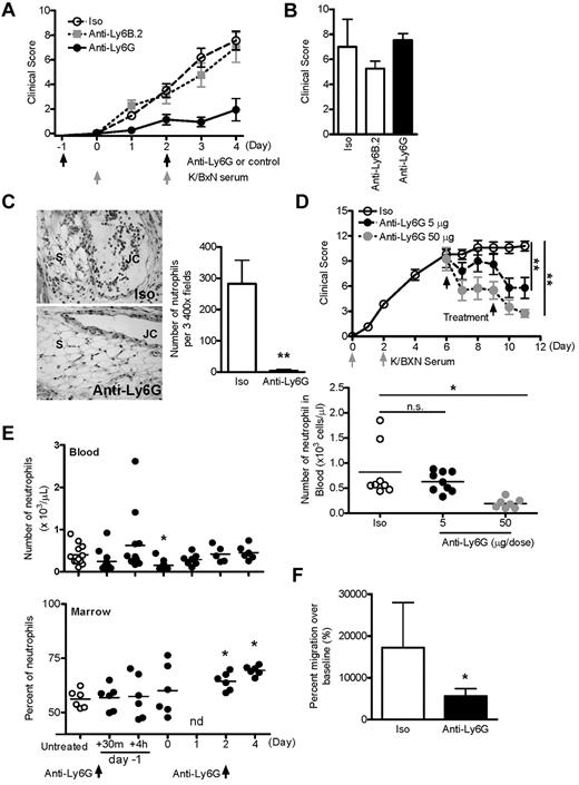 Figure 2. Anti-Ly6G attenuates arthritis and inhibits neutrophil recruitment in joints and peritoneum. (A) Arthritic response of mice given 5 μg of Ab twice and 150 μL of K/BxN serum (rat IgG2a isotype, n = 14; anti-Ly6B.2, n = 8; anti-Ly6G, n = 12 pooled from 2-6 experiments). Shown is isotype (Iso) versus anti-Ly6G. P < .0001 by ANOVA. (B) K/BxN serum–induced flare was assessed 30 minutes after the first injection of K/BxN serum using the same scoring system as in panel A. (C) Representative sections of day-4 ankle histopathology from mice receiving isotype control Ab or anti-Ly6G (H&E stain; 20× objective). JC indicates joint cavity; and S, synovium. Right panel shows the quantification of neutrophils per 3 high-power field of day-4 ankle tissue (n = 12-18 ankles). (D) Treatment of active arthritis with nondepleting and depleting doses of anti-Ly6G. Two doses of anti-Ly6G at 5 or 50 μg/dose or control Ab at 50 μg/dose were administered intraperitoneally on days 6 and 9 of active arthritis. Circulating neutrophils were enumerated by automated cytometer on day 11. (E) Effect of anti-Ly6G (5 μg intraperitoneally on days −1 and 2) on neutrophils in the blood and BM of otherwise unmanipulated mice (n = 5-12 mice/time point from 4 experiments). There was a trend toward decreased neutrophil counts in blood 30 minutes after injection (P = .12). nd indicates not done. (F) Anti-Ly6G (5 μg) was administered intraperitoneally to nonarthritic mice and TG instilled intraperitoneally at the equivalent of day 4 of arthritis. Peritoneal cells were harvested at 4 hours by lavage and neutrophils enumerated by flow cytometry. Data are from n = 6 animals per group from 2 experiments. *P < .05; **P < .01.