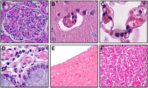 Figure 4. Lack of cardiovascular pathology in SIVagm-infected AGMs. Histological investigations of kidney (A), brain (B), lung (C), intestine (D), aorta (E), and heart (F) in chronically SIVagm-infected AGMs failed to identify cardiovascular lesions. Slides were visualized with a Carl Zeiss Axio Imager M1 microscope using the following objectives: 10×/0.3 DICI Plan Neofluar, 20×/0.8 DICII Plan Apochromat, and 40×/0.75 DICII Plan Neofluar. Micrographs were taken with a Carl Zeiss AxioCam MRc5. Images were aquired and analyzed by using Carl Zeiss Axio Vision SE64 Release 4.8.2. The original magnification of all the pictures was 400×. Images were cropped with Adobe Photoshop CS6.
