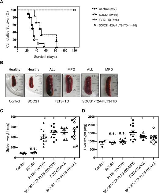 Figure 5. SOCS1 cooperates with FLT3-ITD–induced disease in a murine bone marrow transplant model. (A) Kaplan-Meyer plot displays the survival after transplantation. All mice that received transplants of control or SOCS1-transduced bone marrow survived the 120 days of follow up. All animals from FLT3-ITD and SOCS1-T2A-FLT3-ITD died before the end of the experiment (120 days). Open circles/triangles represent ALL phenotype, filled circles/triangles represent MPD phenotype, and half-filled circles/triangles represent both events. (B) Representative microphotographs of spleens at the time of death. Spleens from control and SOCS1 mice (from 120 days after transplantation) or from FLT3-ITD and SOCS1-T2A-FLT3-ITD moribund mice indicate normal and enlarged spleens, respectively. (C-D) Analysis of spleen weight (C) and liver weight (D) at death or at the end of experiment (120 days). The mice that received FLT3-ITD and SOCS1-T2A-FLT3-ITD transplants suffered from splenomegaly compared with controls (C). In addition, mice transplanted with SOCS1-T2A-FLT3-ITD/MPD suffered from significantly increased hepatomegaly, compared with FLT3-ITD/MPD (D; * P < .05).