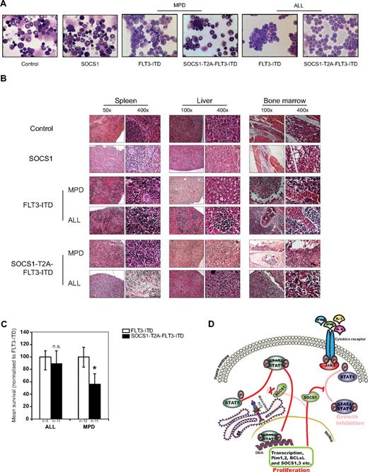 Figure 6. SOCS1 coexpression with FLT3-ITD accelerates the development of MPD. (A) Representative bone marrow cytospins from 120-day posttransplantation control and SOCS1 or from FLT3-ITD and SOCS1-T2A-FLT3-ITD moribund mice at the time of death, indicating MPD and ALL, respectively. (B) H&E staining of tissues (spleen, liver, and bone marrow) from control and SOCS1 mice and leukemic FLT3-ITD and SOCS1-T2A-FLT3-ITD mice, indicating MPD and ALL, respectively. Data are representative moribund FLT3-ITD and SOCS1-T2A-FLT3-ITD mice that died of MPD or ALL. (C) Comparison of mean survival (normalized to FLT3-ITD) from 2 independent transplantation experiments. Similar latency in ALL and significantly different latency in the MPD phenotype are shown. (D) Mechanistic model for the cooperation of SOCS1 in FLT3-ITD–mediated leukemogenesis. As we have described recently, constitutively active oncogenic FLT3-ITD directly phosphorylates STAT5 from the endoplasmic reticulum.21,22 On phosphorylation, STAT5 dimerizes and translocates into nucleus and induces transcription of STAT5 target genes that includes SOCS1. FLT3-ITD–induced SOCS1 expression neither affects FLT3-ITD–mediated proliferative signals nor STAT5 activation, whereas it terminates cytokine-dependent signals. Thereby, SOCS proteins cooperate with FLT3-ITD by “shielding” the cell from cytokine control (eg, IFNα, IFN-γ, IL-3, and IL-6; *P < .05).
