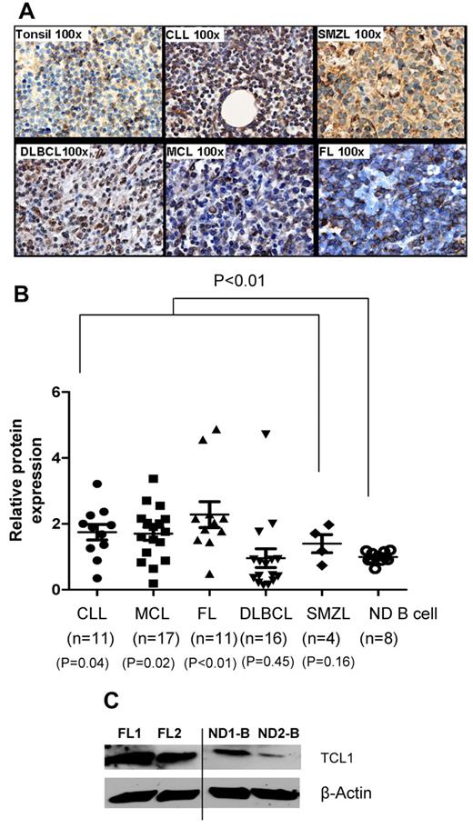 Figure 2. TCL1 protein is hyperexpressed in multiple B-cell lymphomas. (A) Expression of TCL1 protein was determined by immunohistochemistry in formalin-fixed, paraffin-embedded primary human lymphoma tissues (FL, n = 5; CLL, n = 2; MCL, n = 3; DLBCL, n = 2; and SMZL, n = 3) and reactive human tonsils (n = 4). Images shown are the original magnification, ×100. (B) Intracellular staining for TCL1 was performed on primary human lymphoma cells and normal human peripheral blood B cells, and samples were analyzed by flow cytometry. The relative expression of TCL1 was calculated as follows: mean fluorescence intensity of TCL1 in test sample/mean fluorescence intensity of TCL1 in normal B cells. Horizontal lines represent the median value for each group. P value on the top of graph represents comparison between normal donor B cells and all lymphomas. P values below the graph represent comparison between normal donor B cells and each lymphoma subtype. All P values were calculated by 2-tailed Student t test (C) TCL1 protein expression was determined by Western blotting in 2 FL and 2 normal donor (ND) peripheral blood B cells. β-Actin protein expression was used as loading control. Vertical line inserted between lanes 2 and 3 to indicate repositioned gel lanes obtained from the same gel.
