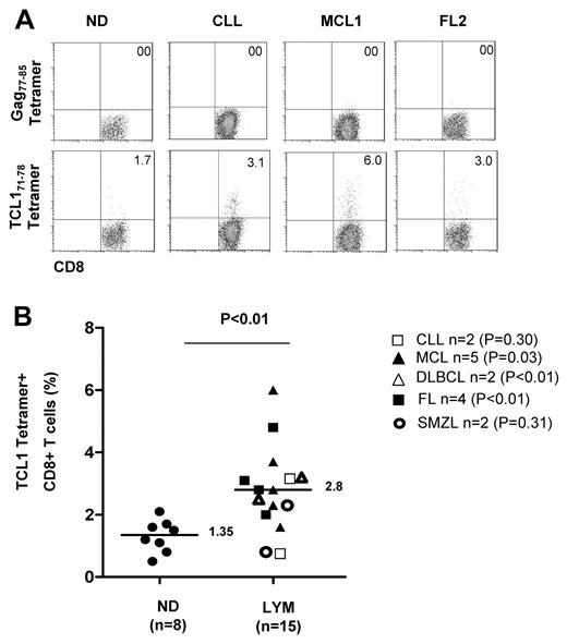 Figure 7. TCL171-78 peptide-specific T cells are increased in lymphoma patients. PBMCs from HLA-A2+ ND (n = 8) or lymphoma patients (CLL, n = 2; MCL, n = 5; FL, n = 4; DLBCL, n = 2; and SMZL, n = 2) were stimulated in vitro twice with TCL165-79 peptide and stained with TCL171-78 tetramer or HIV Gag77-85 tetramer. Representative data of the tetramer staining (A) and results from all samples analyzed (B) are shown. P value on the top of graph represents comparison between normal donors and all lymphoma patient samples. P values to the right represent comparison between normal donors and patients from each lymphoma subtype. All P values were calculated by 2-tailed Student t test.