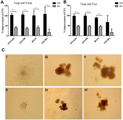 Figure 6. Defective immunosuppression by AA Tregs contributed to impaired hematopoiesis in vitro. (A-B) Percentages of improvement of the numbers of CFU in presence of the supernatants obtained from the cocultured systems (AA patients, n = 6; controls, n = 6). (C) The sizes of CFU-GM, BFU-E, and CFU-Mix in presence of the cocultured supernatants from AA patients (ii,iv,vi) were significantly smaller than those from controls (i,iii,v). *P < .05; **P < .001.