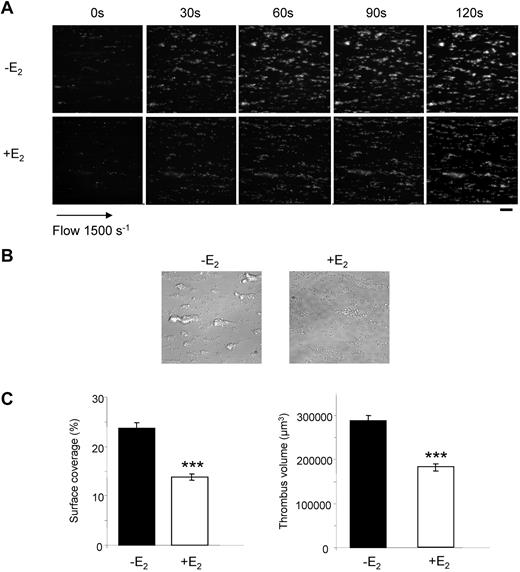Figure 3. Thrombus formation defect in E2-treated mice. DiOC6-labeled platelets in whole blood were perfused over a collagen-coated surface at a wall shear rate of 1500 seconds−1 for 2 minutes. (A) Thrombus formation was visualized with a 40× long working distance objective in real time and then imaged by transmitted light microscopy (scale bar: 20 μm). (B) Representative phase contrast images taken at the end of the experiment. (C) Surface area covered by thrombi and thrombus volume were measured at 2 surface locations. Results are mean values ± SEM from 4 independent experiments. ***Significant difference (P < .001).