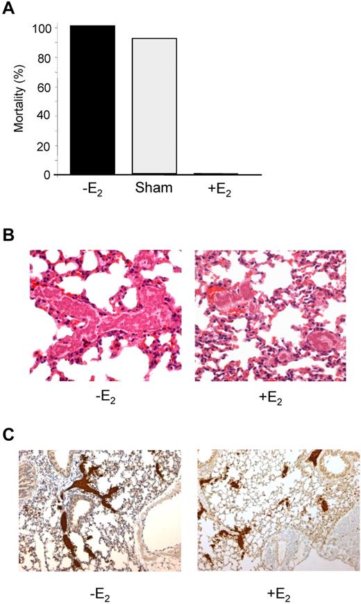 Figure 5. E2-treated mice are protected from collagen/epinephrine-induced thromboembolism. (A) Thromboembolism was induced by injection of a collagen (0.4 mg/kg) and epinephrine (60 μg/kg) mixture into the jugular vein. All non-E2–treated mice (12 of 12) and 11 of 12 sham-operated mice died within 5 minutes, whereas all E2-treated mice (10 of 10) survived. (B) Representative sections of hematoxylin-eosin–stained lungs from a control mouse that died during the assay and an E2-treated mouse that survived and was killed 10 minutes after injection of collagen/epinephrine mixture. Original magnification ×400. (C) Platelet staining (αIIb in brown) of lung sections from mice treated or not with E2. Original magnification, ×100.