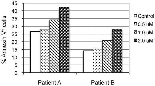 Figure 7. NSC697923 induces cell death of primary DLBCL cells. Primary cancer cells prepared from tumor specimens of 2 DLBCL patients were seeded at 4.5 × 105 cells/mL in RPMI medium supplemented with 20% FBS and treated with the indicated concentrations of NSC697923 for 24 hours. The apoptotic cells were analyzed as described in Figure 5E. Shown are the averages from 2 independent experiments.