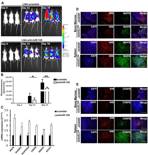 Figure 3. Inhibition of miR-155 decreases tumor growth in a xenograft mouse model of WM. Immediately after injection of mCherry-Luc+-BCWM1 cells, 6 SCID mice per group were injected with a loading dose of 25 mg/kg of anti–miR-155 or scramble control, followed by weekly maintenance doses of 5 mg/kg of anti–miR-155 or scramble control until mice were killed. (A) Bioluminescent imaging of tumor burden from mice injected with mCherry-Luc+-BCWM1 cells at day 0, 14, or 19. (B) Treatment with the anti–miR-155 decreased tumor burden significantly compared with scramble control as evaluated by whole body imaging. Three representative mice from each group are shown. P = .024 at day 14; P = .009 at day 19 (n = 6 per group). Data are shown as means ± SD. *P < .05; **P < .01. (C) mRNA levels of miR-155 targets were detected by qRT-PCR in the BM CD19+ cells from mice treated with anti–miR-155 or LNA scramble control. Experiments were performed in triplicate and repeated 3 times. Data are shown as means ± SD. (D-E) Protein levels of the miR-155 target genes MAFB (D) and CEBPβ (E) were detected by immunofluorescent imaging from the femur BM or spleens of mice. Cell nuclei are shown by DAPI staining in blue; mCherry-Luc+-BCWM1 cells in red. MAFB or CEBPβ proteins were detected by immunostaining with anti-MAFB or anti-CEBPβ. Scale bar indicates 100 μm.