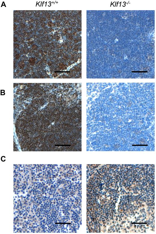 Figure 1. Immunohistochemistry of KLF13 in mouse and human tissues. (A) Murine thymus. (B) Murine spleen. (C) Human lymph node (left panel) and tonsil (right panel). Scale bar is 50 μm.