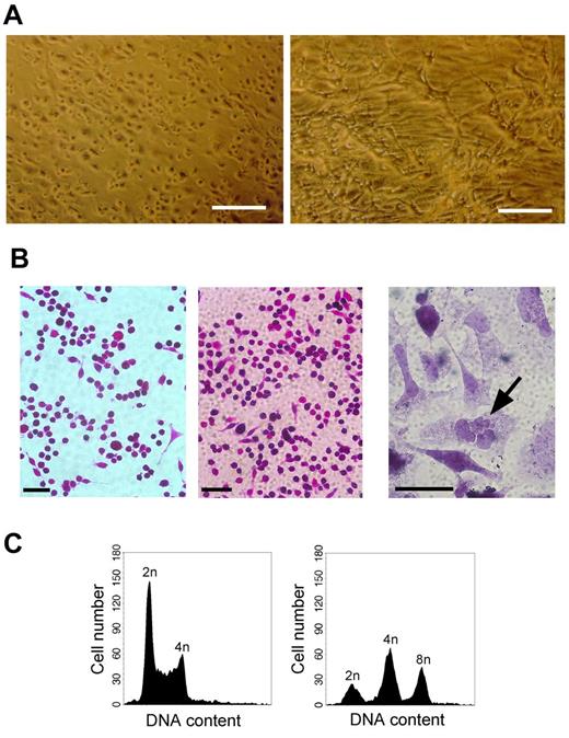 Figure 2. HEL cells show a megakaryocytic phenotype on TPA treatment. (A) HEL cells do not form tubule-like structures on collagen. HEL cells (left panel) and Bovine LECs, which served as a positive control (right panel), were grown on collagen gels in the presence of 30 ng/mL of VEGF165. Scale bars indicate 200 μm. Microscope: Zeiss Axiovert 25, LD Achrostigmat 20×/0,30; room temperature. Camera: Ricoh single-lens reflex camera; reversal film. (B) TPA treatment induces a polynucleated phenotype in HEL cells. HEL cells were cultivated on a collagen-coated surface in the presence of TPA, ethanol as a solvent control, or left untreated. After 8 days, the cells were fixed and H&E stained. Scale bars indicate 400 μm (controls); 200 μm (TPA treatment). Microscope: Zeiss Axiovert 25, LD Achrostigmat 20×/0,30; room temperature. Camera: Ricoh single-lens reflex camera; reversal film. (C) TPA induces polyploidy in HEL cells. HEL cells were treated or not with TPA for 72 hours, harvested, fixed, and their DNA stained with Draq 5. Ploidy of untreated (left panel) and TPA-treated (right panel) HEL cells was assessed flow cytometrically.