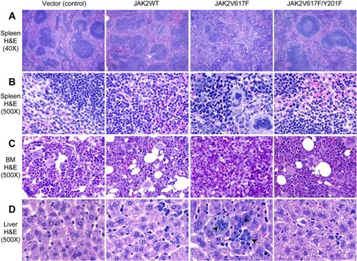 Figure 5. Histopathologic characterization of the transplanted animals. (A-B) Hematoxylin and eosin stains of the spleens (original magnification ×40 and 500) obtained from vector (control) and JAK2WT expressing mice show normal architecture and minimal extramedullary hematopoiesis. Spleens of JAK2V617F-expressing mice show marked distortion of the splenic architecture with an attenuation of the white pulp and expansion of the red pulp containing abundant extramedullary hematopoiesis, including megakaryocytes and erythroid and granulocyte precursors. JAK2V617F/Y201F-expressing mice show minimal alteration of the architecture with only mild extramedullary hematopoiesis. (C) BM sections (hematoxylin and eosin stain; original magnification ×500) from JAK2V617F-expressing mice show hypercellularity with increased and dysplastic megakaryocytes and increase in granulopoiesis. JAK2V617F/Y201F mouse BM was essentially normal and resembles that of control animals. (D) Liver sections (hematoxylin and eosin stain; original magnification ×500) from JAK2V617F-expressing mice show extramedullary hematopoiesis, whereas livers of JAK2V617F/Y201F mice appear identical to those of control animals. Arrows indicate megakaryocytes and granulocytes in the liver of JAK2V617F mice.