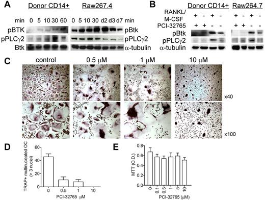 Figure 1. PCI-32765 blocked Btk-mediating osteoclastogenic signaling pathway and impacted osteoclastogenesis. (A) CD14+ OC precursor cells (OCPs) from normal human donor or mouse raw267.4 cells were stimulated with RANKL/M-CSF for the indicated time intervals. Cell lysates were subjected to immunoblotting with antiphosphotyrosine antibodies. Anti–α-tubulin and -Btk mAbs served as loading controls. (B) OCPs were pretreated with (+) or without (−) PCI-32765 (100nM) for 2 hours before stimulation with RANKL/M-CSF. (C) TRAP staining was performed at 10 days of OC culture to identify mature OCs (> 3 nuclei, > 50 μm per cell; original magnification ×40 and ×100). (D) TRAP-positive multinucleated OCs were quantified (P < .01) and assayed by MTT (E).