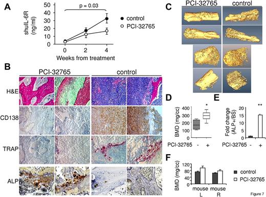 Figure 7. PCI-32765 inhibits MM cell growth and MM-induced bone lysis in a murine model of human MM. (A) SCID-hu mice were injected with INA-6 MM cells into the implanted human bone and continuously treated with PCI-32765 (12 mg/kg, n = 6) or vehicle control (n = 5) beginning after first detection of tumor by monitoring shuIL-6R in mouse serum samples weekly. (B) Bone chips were retrieved from SCID-hu mice, decalcified, and sectioned. Tissue slides were stained with H&E and immunohistochemically analyzed for CD138 (MM), TRAP (OC), and ALP (OB). Original magnification ×200, except for ALP (original magnification ×400). (C) Representative cross-sectional images by 3-dimensional reconstruction of the harvested human bones obtained after performing high-resolution micro-CT scan are shown and quantified (D). *P < .04. (E) Osteogenic activity per bone surface (ALP+/BS), indicating bone formation activity. **P < .01. The PCI-32765-treated group displayed significantly reduced osteolysis induced by MM cells and enhanced osteogenic activity, compared with vehicle control group. Effects of PCI-32765 were also quantitated in the left (mouse L) and right (mouse R) normal mouse extremities (F).