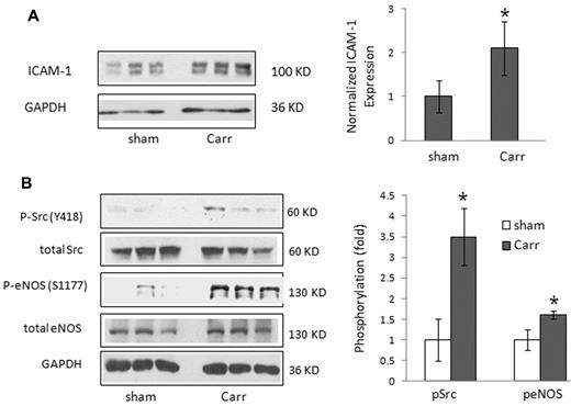 Figure 1. ICAM-1 expression, neutrophil (PMN) infiltration into the lung, and activation of Src and eNOS in carrageenan-treated mouse lungs. (A) Mice were injected in the pleural space with 1% carrageenan or saline (sham); and after 4 hours, lung tissue was collected and analyzed. ICAM-1 expression was determined by Western blot and densitometry (mean ± SD; n = 3, lung tissues from 3 mice in each group). *P < .05 versus sham. (B) Activation of Src and eNOS was determined by Western blot analysis. Tyrosine phosphorylation of Src at Y418 and serine phosphorylation of eNOS at S1177 were detected (triplicates are shown) by Western blotting mouse lung homogenates. *P < .05 versus sham.