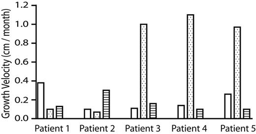 Figure 2. Clinical outcome of children with OI after bone marrow MNC infusion. The mean growth velocity (centimeters per month) of patients is shown during the 6 months before MNC infusion (□), the first 3-month interval (), and the second 3-month interval (▤) after MNC infusion.