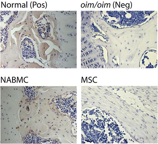 Figure 3. Photomicrographs of bone from oim/oim mice after cell infusions. Mice were infused with either NABMC or MSCs from wild-type mice and then the bones were immunostained with a polyclonal antibody which recognizes only the proα2 polypeptide (not proα1) and visualized with NOVARed. The positive control (top left panel) is normal mouse bone which demonstrates staining of the trabecular bone but not the growth-plate cartilage on the right side of the section. The negative control (top right panel) is oim/oim mouse bone, which does not express proα2 peptide. Oim/oim mice infused with NABMC (bottom left panel) show red stain (proα2 expression) in the trabecular bone but not the articular cartilage on the left side of the section. Oim/oim mice infused with MSCs (bottom right panel) lack any red staining indicating the lack of detectable proα2. Original magnification, ×200.