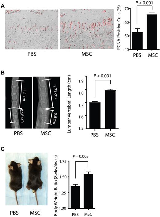 Figure 5. The effect of MSCs in vivo. (A) PCNA immunohistochemical staining was performed on the sections of MSC- and PBS-injected mice, and the percentage of PCNA-positive cells in the growth plate was determined. 3,3′-diaminobenzidine signals were pseudocolored red. A representative picture of each group is shown. Original magnification, ×200 (P < .001, n = 12). (B left panel) Representative photographs of lumbar vertebrae of 8-week-old oim/oim mice, 4 weeks after PBS or MSC infusion, or PBS-injected oim/oim mice at 8 weeks old. (Right panel) Lumbar vertebral length of each group (P < .001, n = 4). (C left panel) Photographs of representative 8-week-old oim/oim mice 4 weeks after PBS or MSC infusion. (Right panel) The 8-week-old: 4-week-old body-weight ratio of oim/oim after PBS or MSC infusion (P = .003, PBS group, n = 7; MSC group, n = 10). All data are mean ± SEM.