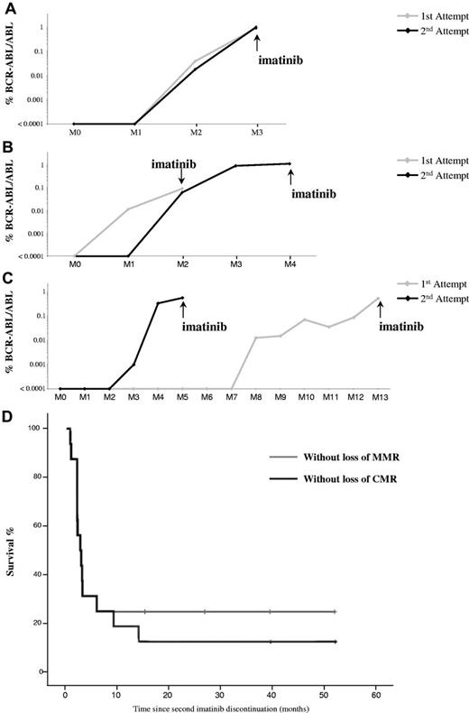 Figure 1. Molecular course after imatinib discontinuation. Comparison of molecular relapse kinetics between the 2 instances of imatinib discontinuation in patients with treatment reintroduction. (A) Example of similar molecular relapse kinetics. (B) Example of second molecular relapse kinetics slower than the first. (C) Example of second molecular relapse kinetics faster than the first. (D) Kaplan-Meier estimates MMR (gray curve) and CMR (black curve) after a second discontinuation of imatinib in patients with chronic myeloid leukemia.