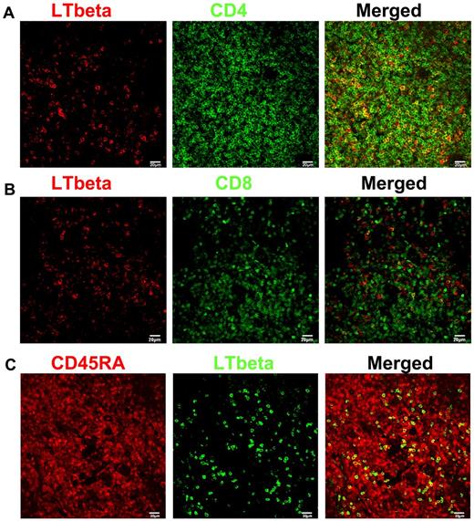 Figure 1. CD4+ T cells are the major producers of lymphotoxin-β (LTbeta). (A-B) Immunofluorescent staining of LTbeta (red), CD4 or CD8 (green) in LNs from rhesus macaques (RMs), showing that LTbeta is mainly expressed by CD4+ T cells. (C) Immunofluorescent staining of CD45RA (red), LTbeta (green) in LNs from RMs, showing that LTbeta is mainly expressed by naive T cells.