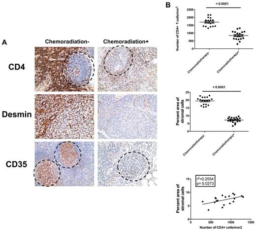 Figure 7. Depletion of CD4+ T cells by chemoradiotherapy leads to depletion of FRC and FDC networks in cancer patients. (A) Immunohistochemical staining of CD4, CD35, and desmin in LNs from chemoradiotherapy-treated patients and untreated patients, showing the depletion of CD4 T cells in B-cell follicles and T-cell zone correlates with depletion of FDCs and FRCs. Dotted circles represent the position of B-cell follicles. Original magnification ×200. (B) Quantitative image analysis of the number of CD4 T cells (top panel) and amount of stromal cells (middle panel) within LNs of chemoradiotherapy-treated patients and untreated patients, showing that both CD4 T cells and stromal cells are depleted during chemoradiotherapy. The depletion of CD4 T cells significantly correlates with the depletion of stromal cells within chemoradiotherapy-treated patients.