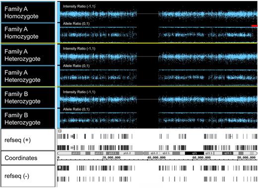 Figure 1. Copy number analyses via single nucleotide polymorphism microarray. Whole-genome SNP typing was performed using DNA from the patients indicated and the Illumina HumanHap 550 Bead Chip array. The figure shows SNPs from 3 patients on chromosome 16. For each patient, the top panel represents the intensity ratio, and the bottom panel represents the allele ratio. Intensity ratio is a measure of patient SNP log signal intensity compared with reference sample SNP intensity; 2 copies = intensity ratio of 0; 1 copy = intensity ratio of −1. Most values are centered around zero, indicating diploid copy number. Allele ratio is the ratio of the signal for one of 2 genotypes over the total signal. Homozygous SNPs localize to 0 or 1; heterozygous SNPs localize to 0.5. In Family A homozygote III-15, genotyping data in the 16q24.2-16qter candidate region demonstrate an extended block of homozygosity extending to the telomeric end of chromosome 16 (red bar). Note that the intensity ratio in this region is unchanged, indicating the homozygosity is not caused by a large deletion. The bottom panel shows, from top to bottom, (+) strand genes, cytogenetic bands, chromosome position, and (−) strand genes.