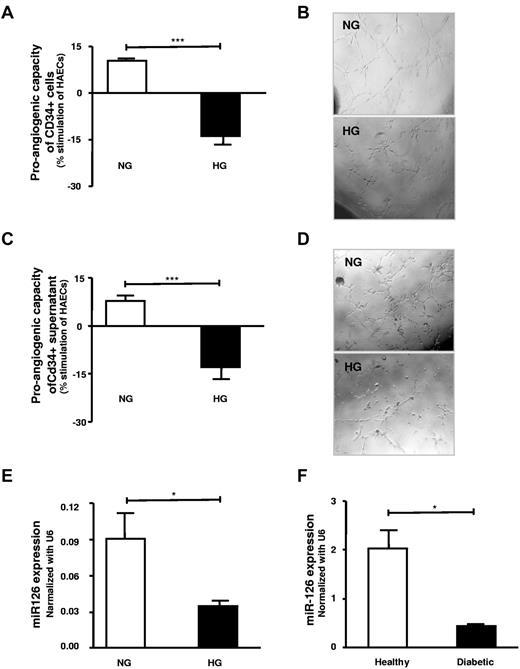 Figure 6. High-glucose exposure/diabetes leads to loss of proangiogenic effects and miR-126 expression and release from CD34+ PBMCs. (A) Effect of high-glucose 25mM (black) treatment compared with the normal glucose-treated CD34+ cells (n = 5-10). (B) Representative photographs of tube formation in high-power field. (C) Supernatant of high-glucose (■) treated cells as opposed to normal glucose (□) their effect on tube formation (n = 6-8). (D) Photographs of tube formation in high-power field. (E) Assessment of miR-126 in high-glucose–treated healthy CD34+ cells compared with untreated CD34+ cells (n = 4). (F) Assessment of the miR-126 levels in patients with type 2 diabetes (■) CD34+ cells in comparison with healthy subjects (□; n = 3). HG indicates high glucose; and NG, normal glucose. Data are mean ± SEM.