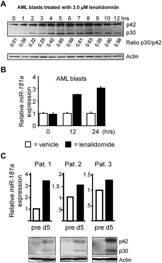 Figure 5. Increased C/EBPα-p30 expression after treatment with the immunomodulatory compound, lenalidomide. (A) Western blot analysis of AML patient blasts treated in vitro with 3.0μM lenalidomide followed by hourly collections. The expression of C/EBPα (p30 and p42) was detected by C/EBPα antibody. The signal intensities were assessed and the p30/p42 ratios were calculated (shown below C/EBPα stained blot). Staining with Actin antibody served as an internal loading control. The data shown are representative for 3 patient samples. (B) Quantitative real-time RT-PCR data for miR-181a expression in the same AML blasts shown in panel A. The expression of miR-181a was increased at 12 hours and 24 hours after 3.0μM lenalidomide treatment (black bars) compared with the vehicle control (white bars) for the same time point. Average of triplicate measurements from a single patient sample is shown and error bars denote SEM. Similar results shown in panels A and B were observed in a total of 3 separate AML patient blasts used in the same experiment (not shown). Additional data from the long-term in vitro treatment with lenalidomide are shown in supplemental Figure 3. (C) Quantitative real-time RT-PCR data from 3 bone marrow samples from patients treated with lenalidomide induction therapy (top). Samples were analyzed before treatment (white bars) and 5 days after lenalidomide induction therapy (black bars). Data are shown as average of triplicate measurements and error bars denote SEM. Increased expression of miR-181a was observed on day 5 after lenalidomide induction therapy. Corresponding whole cell lysates for those patients were analyzed using Western blot (bottom). The expression of C/EBPα (p42 and p30) was increased on day 5 after lenalidomide induction therapy. Actin served as an internal loading control. Patients' cytogenetic and clinical characteristics before the therapy are summarized in supplemental Table 1.