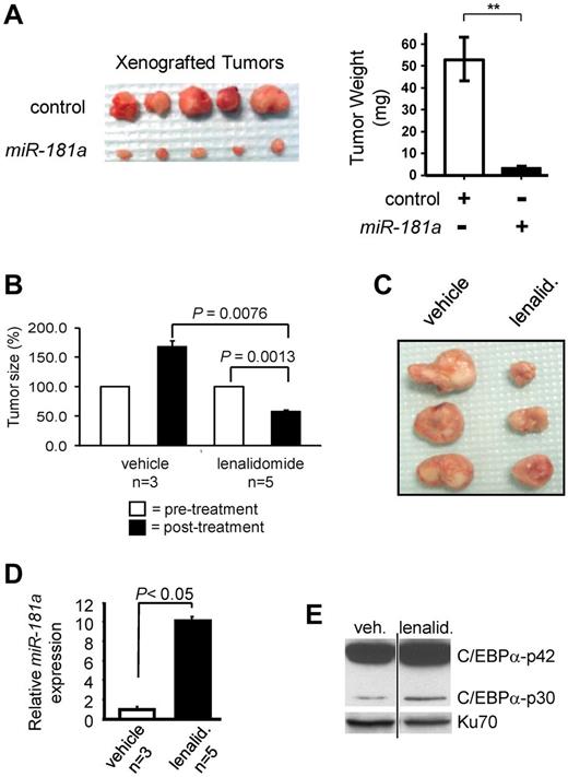 Figure 7. Lenalidomide treatment in vivo induces miR-181a-mediated inhibition of xenograft AML tumor growth. (A) THP-1 cells were transiently transfected with empty expression vector (control), or construct expressing the ectopic miR-181a and injected subcutaneously into NOD/SCID mice (5 mice per construct). Six weeks later the tumors were excised (left) and their sizes were determined (right). (B-E) THP-1 cells were xenografted subcutaneously to NOD/SCID mice (1 tumor per mouse). Four weeks later, tumors were directly injected with lenalidomide (lenalid.; 50 mg/kg; n = 5) or vehicle control (n = 3), twice a week for 2 weeks. Six weeks after transplantation mice were killed and tumors excised. (B) Xenograft tumors assessed at the onset (white bars) and the end (black bars) of the treatment. Measurements were plotted as the relative percentages of the tumors at the beginning of the treatment. (C) Dissected tumors after the lenalidomide treatment (lenalid.; on the right) or vehicle control (on the left). (D) Quantitative real-time RT-PCR assessment of miR-181a expression for the xenografts after treatment with either lenalidomide (lenalid.; black bar) or vehicle (white bar). (E) The relative expression of C/EBPα-p42 and C/EBPα-p30 in lenalidomide (lenalid.) or vehicle-treated xenograft tumors was evaluated by Western blot of nuclear extracts prepared from the tumors. Blot was stained with C/EBPα antibody and staining with Ku70 served as a loading control. Both lanes were from the same blot and same exposure. Vertical line has been inserted to indicate repositioned gel lanes.