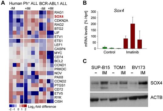 Figure 1. Up-regulation of SOX4 in response to TKI treatment in Ph+ ALL. Ph+ ALL (BV173, SUP-B15, TOM1, and NALM1; supplemental Table 6) and murine pre-B ALL were treated with the tyrosine kinase inhibitor (TKI) Imatinib for 16 hours (IM; A). Based on gene expression analyses we identified SOX4 as a gene that is highly up-regulated. BCR-ABL1–transformed mouse pre-B ALL cells were treated with or without Imatinib (IM; 2μM) for 16 hours and mRNA levels of SOX4 were measured by quantitative RT-PCR (B). In panel C, 3 human Ph+ ALL cell lines were treated with or without Imatinib (IM; 2μM) for 16 hours and SOX4 protein levels were assayed by Western blot using β-actin as loading control.