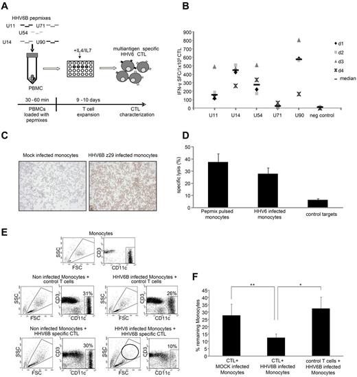 Figure 4. HHV6B multiantigen-specific CTLs kill HHV6B wild-type virus-infected targets. (A) Schematic of our multiantigen-specific HHV6 CTL generation process. (B) By IFN-γ ELISPOT, these multiantigen-specific lines were specific for the stimulating pepmixes. Results are expressed as SFCs/1 × 105 input cells. (C) IHC analysis of CD14-selected monocytes infected with the HHV6B wild-type virus strain Z29 or the mock-infected controls. The IHC pictures were taken using 10× magnification at an exposure of 6 ms on an Olympus BX41 microscope, and images were captured using Q-capture software (Q-imaging). Autologous monocytes alone, or pepmix-pulsed or HHV6 wild-type virus-infected cells, were used as targets in a standard 4-6 hour Cr51 release assay (D). Data are mean ± SEM (% specific lysis at an effector/target ratio of 40:1; n = 4). (E) Representative FACS results of a 24-hour coculture assay where either uninfected or HHV6 Z29-infected autologous monocytes (CD11c+) were cultured with nonspecific or HHV6 multiantigen-specific CTLs (CD3+). (F) Summary results from 4 donors where the percentage of residual monocytes after treatment, as quantified by FACS analysis, were plotted (mean ± SD).