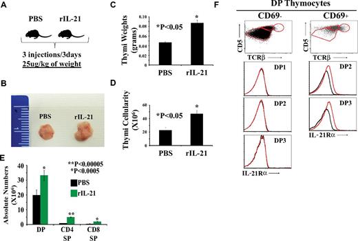 Figure 7. The effect of rIL-21 injection on thymi of old WT C57Bl/6 mice. (A) Schematic diagram of the experimental design. Three mice per group were tested. (B) Representative photograph of thymi derived from PBS- versus rIL-21–treated mice. (C-D) Thymic weight and cellularity. (E) Absolute numbers of DP, SP CD4, and CD8 T cells. (F) Analysis of IL-21Rα chain on the surface of preselected (CD69−) or postselected (CD69+) DP subsets. Data are representative of 3 separate experiments.