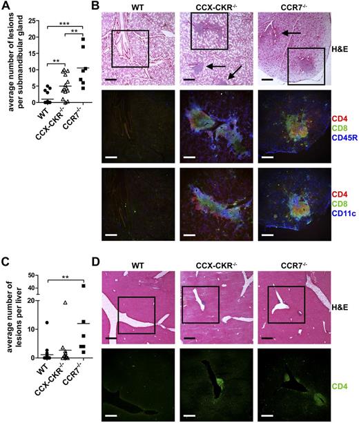 Figure 1. Deletion of CCX-CKR results in enhanced spontaneous autoimmunity characterized by lymphocytic infiltrate in 8- to 10-month-old mice. (A) Quantitation of the average number of lesions identified in 3 sections per gland cut ∼ 100 μm apart, with the second section being the approximate middle of the tissue. WT, n = 16; CCX-CKR−/−, n = 14; and CCR7−/−, n = 7. Bars represent means. (B) Serial sections of submandibular glands were stained with hematoxylin and eosin (H&E) to identify lesions (indicated with arrows). Boxed region indicates areas shown below stained with anti-CD4, anti-CD8, anti-CD11c, and anti-CD45R to identify infiltrating cell populations. (C) Same as panel A, but in the liver. (D) Serial sections of the liver stained with H&E to identify lesions. Boxed region represents areas shown below stained with anti-CD4. H&E scale bar represents 400 μm. IF scale bar represents 250 μm. (A,C) One-way ANOVA with Bonferroni posttest. *P < .05. **P < .01. ***P < .001.