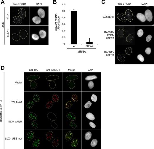 Figure 1. RA3331 FA-P cell line is null for SLX4. (A) Indirect immunofluorescence with an antibody against ERCC1 in U2OS cells transfected with a combination of 3 siRNAs against SLX4 or against Luciferase (Luc) as a control. The U2OS cells were pre-extracted with Triton-X100 before fixation. Nuclei were stained with 4,6-diamidino-2-phenylindole (DAPI). (B) Efficiency of SLX4 knockdown. The bar graph represents the decrease in relative SLX4 mRNA in U2OS cell line transfected with Luc or SLX4 siRNA. The error bars represent SD in triplicate experiments. (C) Indirect immunofluorescence with an antibody against ERCC1 in BJ/hTERT, RA3083/hTERT, and RA3331/E6E7/hTERT cell lines. The cell lines were prepared as in panel A. (D) Indirect immunofluorescence staining of RA3331/E6E7/hTERT expressing indicated SLX4 mutants using anti-HA and anti-ERCC1 antibodies. Nuclei were stained with DAPI. The cell lines were prepared as in panel A.