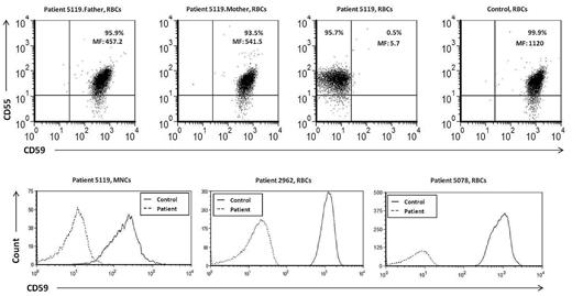 Figure 3. The expression of CD59 and CD55 proteins in RBCs and MNCs. RBCs and MNCs from patients (represented in the figure by patient 5119), carriers of the Cys89Tyr mutation, and a normal control were stained with anti–CD59-FITC and anti–CD-55-PE. Top panel shows RBCs costained with anti–CD59-PE and anti–CD-55-FITC. The percentages of CD-59+ cells are indicated in the right top quadrant together with mean fluorescence (MF). Bottom panel shows MNCs (left) of patient 5119 and RBCs of patients 2962 and 5078 (middle and right) stained for anti–CD59-PE.