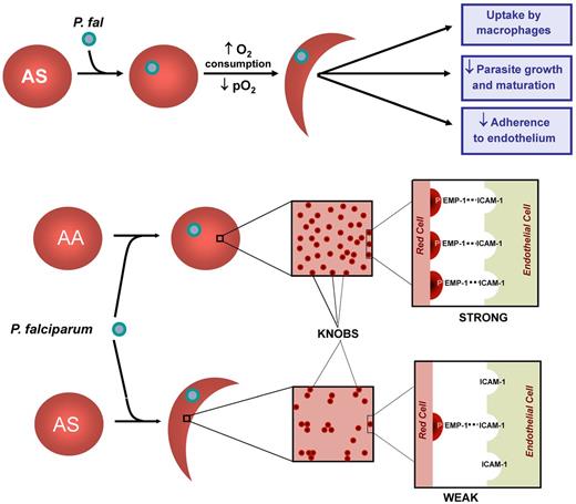 Figure 1. Mechanisms underlying protection by AS RBS against falciparum malaria. Parasitization of AS RBCs causes increased oxygen consumption, a decrease in pO2, and sickle hemoglobin polymerization. The membranes of these cells are further modified by oxidant stress, resulting in uptake by macrophages, impaired parasite growth and development, and decreased adherence to endothelium. Parisitization of AS RBCs leads to a decrease in the display of knobs of the cell surface along with uneven distribution. It is likely, though unproven, that hypoxia-induced sickling would aggravate this abnormal topology and further weaken interactions between the parasite protein PfEMP-1 and cognate receptors on endothelial cells, such as ICAM-1 in the brain.