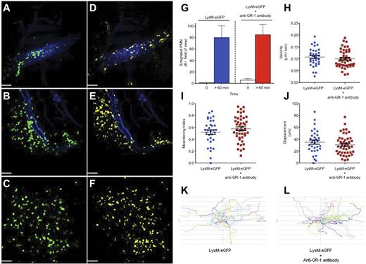 Figure 1. Direct real-time imaging of leukocyte recruitment in vivo using spinning disk confocal intravital microscopy. (A-F) Staphylococcus aureus–infected (intradermal 1 × 108 CFU of methicillin-resistant S aureus, USA300-2406) LysM-eGFP mouse skin microvasculature was imaged in vivo. Images shown in panels A through C demonstrate neutrophils defined by LysM-eGFP expression (green), and the corresponding side-by-side images shown in panels D through F demonstrate neutrophils defined by the anti–Gr-1 antibody (5 μg IV) conjugated to Alexa Fluor 750 (yellow) at identical time points. Endothelium was visualized using an anti–PECAM-1 antibody (10 μg IV) conjugated to Alexa Fluor 647 (blue). (A,D) Images of neutrophils rolling and adhering within a vessel captured immediately after administration of live S aureus into the mouse skin. (B,E) Images of neutrophils transmigrating out of a vessel captured 60 minutes after S aureus administration. (C,F) Images of neutrophils emigrating and chemotaxing within the parenchyma 60 minutes after S aureus administration. Images were captured using an Olympus BX51 upright microscope equipped with a 10×/0.3 numeric aperture air objective. The microscope was equipped with a confocal light path (WaveFx; Quorum) based on a modified CSU-10 head (Yokogawa Electric). Laser excitation at 488, 649, and 730 nm (Cobalt) was used in rapid succession with the appropriate long-pass filters (Semrock). A 512 × 512 pixel back-thinned EMCCD camera (C9100-13; Hamamatsu) was used for fluorescence detection. Volocity Acquisition Version 6.0 software (Improvision) was used to drive the confocal microscope. Images captured using the spinning disk were processed and analyzed in Volocity with linear adjustments to the black-and-white points for improved image quality. Bars represent 60 μm. Images are representative of 3 independent experiments. (G-L) Neutrophil emigration (G), parenchymal tissue crawling velocity (H), meandering index (I), displacement over 10 minutes (J), and tissue neutrophil crawling tracks (K-L) after live S aureus administration in LysM-eGFP mice without antineutrophil antibodies and LysM-eGFP mice that received IV anti–Gr-1 (5 μg) immediately before imaging. For cell quantification, 2 independent LysM-eGFP experiments were compared with 3 independent LysM-eGFP + anti–Gr-1 antibody experiments. All procedures performed were approved by the University of Calgary Animal Care Committee and were in accordance with the Canadian Guidelines for Animal Research.